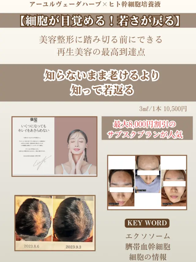 去年11月から取り扱い開始の【HSC強髪】
反響がすごい✨
その理由とは🤔
主に3点がよく耳にするお客様のリアルボイス📣👂
＊1回目からお肌の変化を感じる
＊10分というケアの簡単さ
＊美肌の実感が予想を超える

情報は知らないより知っていた方が選択肢は広がります🙆🙆‍♀️
つまり
自分の可能性が広がり🤩
なりたい自分になれる確率が上がる🎯

ご興味が、少しでもわいたらDMでも構わないのでご連絡ください👍

自分の未来を輝かせるのはご自分です🫡
そのお手伝いができればorsaは最幸です✨

✅orsaはヘアだけにこだわらずお客様のなりたい🥰やりたい🥰
その世界観を作るための、ファクターとして様々な美容を皆様にお伝えしていきます✨
orsaでは過去お客様にお伝えしている情報は、世間の皆様が認識する18ヶ月〜36ヶ月前にローンチしておりますので、顧客様以外の方は、今はご理解が困難でも心配しないでください😊
慌てずで大丈夫です👌
【orsaには情報がある】と覚えていただければ幸いです💯